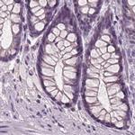 BHLHB5 Antibody in Immunohistochemistry (IHC)