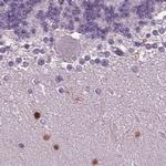 BHLHB5 Antibody in Immunohistochemistry (IHC)