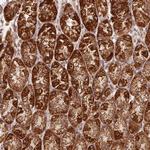 NDUFS6 Antibody in Immunohistochemistry (Paraffin) (IHC (P))