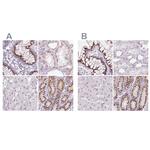 GALNT7 Antibody in Immunohistochemistry (IHC)