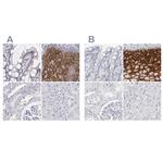 LY6D Antibody in Immunohistochemistry (IHC)