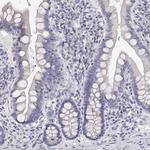 LY6D Antibody in Immunohistochemistry (IHC)