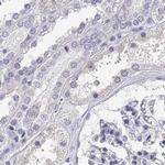 LY6D Antibody in Immunohistochemistry (IHC)