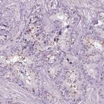 BHLHB5 Antibody in Immunohistochemistry (IHC)