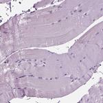 BHLHB5 Antibody in Immunohistochemistry (IHC)