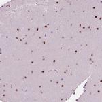 BHLHB5 Antibody in Immunohistochemistry (IHC)