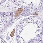 CTRP3 Antibody in Immunohistochemistry (Paraffin) (IHC (P))