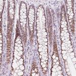 HOXB13 Antibody in Immunohistochemistry (Paraffin) (IHC (P))