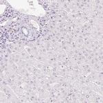 HOXB13 Antibody in Immunohistochemistry (IHC)