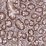 AMER1 Antibody in Immunohistochemistry (Paraffin) (IHC (P))