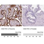 HSD17B1 Antibody in Immunohistochemistry (IHC)