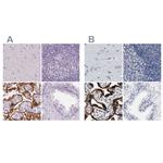 HSD17B1 Antibody in Immunohistochemistry (IHC)