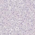 GALNT7 Antibody in Immunohistochemistry (IHC)