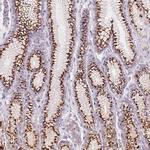 GALNT7 Antibody in Immunohistochemistry (IHC)