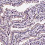 Ferroportin Antibody in Immunohistochemistry (IHC)