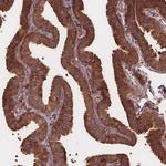 eIF3d Antibody in Immunohistochemistry (Paraffin) (IHC (P))