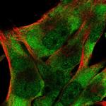 eIF3d Antibody in Immunocytochemistry (ICC/IF)