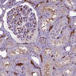 ADAMTS8 Antibody in Immunohistochemistry (Paraffin) (IHC (P))