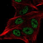 LSM2 Antibody in Immunocytochemistry (ICC/IF)