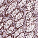 LSM2 Antibody in Immunohistochemistry (Paraffin) (IHC (P))