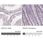 ZNF572 Antibody in Immunohistochemistry (IHC)