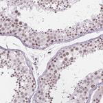 ZNF572 Antibody in Immunohistochemistry (IHC)