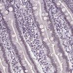 ZNF572 Antibody in Immunohistochemistry (IHC)