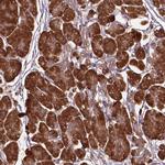 GAS1 Antibody in Immunohistochemistry (Paraffin) (IHC (P))