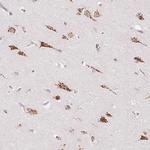 RAB22A Antibody in Immunohistochemistry (Paraffin) (IHC (P))