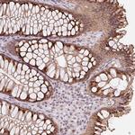 RAB22A Antibody in Immunohistochemistry (Paraffin) (IHC (P))