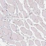 RAB22A Antibody in Immunohistochemistry (Paraffin) (IHC (P))