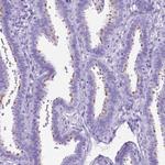 DNAH2 Antibody in Immunohistochemistry (Paraffin) (IHC (P))