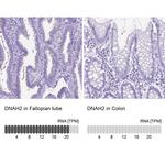 DNAH2 Antibody in Immunohistochemistry (IHC)