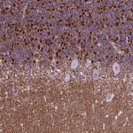 POU3F3 Antibody in Immunohistochemistry (IHC)