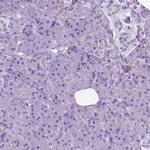 POU3F3 Antibody in Immunohistochemistry (IHC)