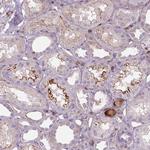 ACAD10 Antibody in Immunohistochemistry (Paraffin) (IHC (P))