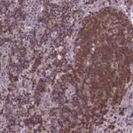 ACAD10 Antibody in Immunohistochemistry (Paraffin) (IHC (P))