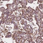 ACAD10 Antibody in Immunohistochemistry (Paraffin) (IHC (P))