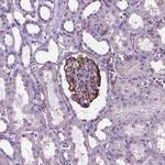 AMOT Antibody in Immunohistochemistry (Paraffin) (IHC (P))