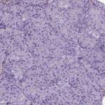 AMOT Antibody in Immunohistochemistry (Paraffin) (IHC (P))