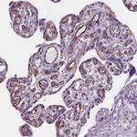 AMOT Antibody in Immunohistochemistry (Paraffin) (IHC (P))