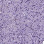 AMOT Antibody in Immunohistochemistry (IHC)