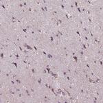 MLC1 Antibody in Immunohistochemistry (Paraffin) (IHC (P))