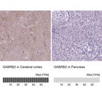 GABRB2 Antibody in Immunohistochemistry (IHC)