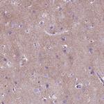 GABRB2 Antibody in Immunohistochemistry (IHC)