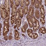 ILVBL Antibody in Immunohistochemistry (Paraffin) (IHC (P))