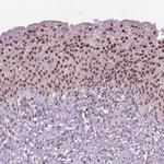 CTR9 Antibody in Immunohistochemistry (Paraffin) (IHC (P))