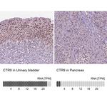 CTR9 Antibody in Immunohistochemistry (IHC)