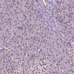 CTR9 Antibody in Immunohistochemistry (IHC)