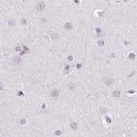 CUZD1 Antibody in Immunohistochemistry (IHC)